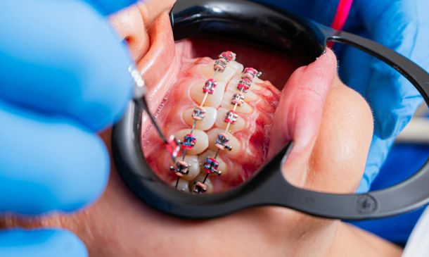 Web Extra: More with Miami City Ballet Artistic Director Gonzalo Garcia 7 boca raton braces for extreme uv exposure and coastal hazards through 1 8 Web Extra: More with Miami City Ballet Artistic Director Gonzalo Garcia